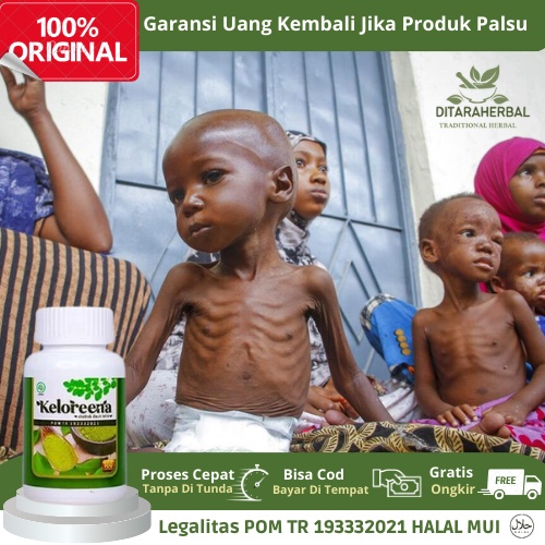 Obat gizi burukObat Gizi Buruk Pada Anak, Obat Penambah Nutrisi Pada Anak, Obat Vitamin Mal Pada Ana