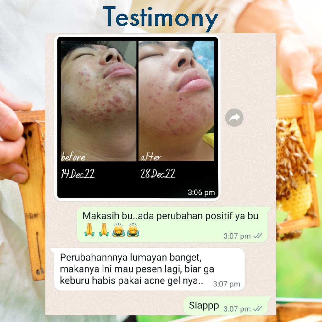 ✅ Efi Care Propolis Acne Treartment by Kebun Efi