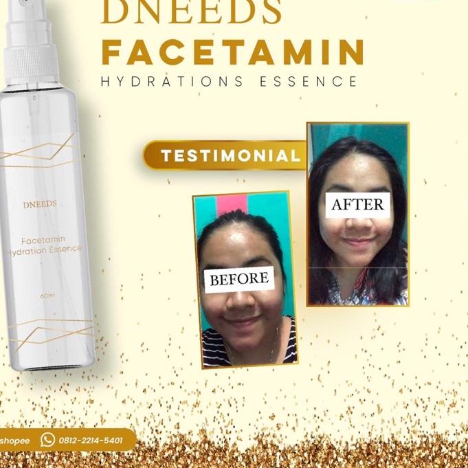 ➷ DNEEDS FACETAMIN ESSENSE ☚