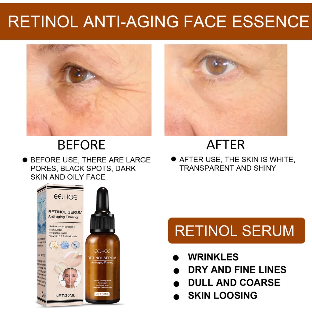 EELHOE Serum Retinol 30ml Anti Keriput ,Melembapkan, Mengecilkan Pori-Pori,Memperbaiki Kulit Yang Rusak/Anti-Aging Face Essence