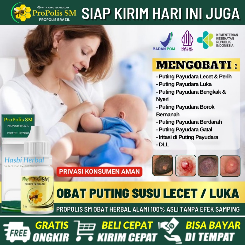 Salep Puting Lecet Menyusui, Cream Puting Susu Lecet, Salep Untuk Puting Susu Lecet, Obat Oles Putin