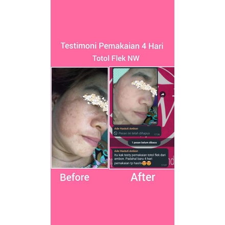 TOTOL FLEK NW BEAUTY GLOW Premium ORIGINAL BPOM (cream siang malam+sabun)