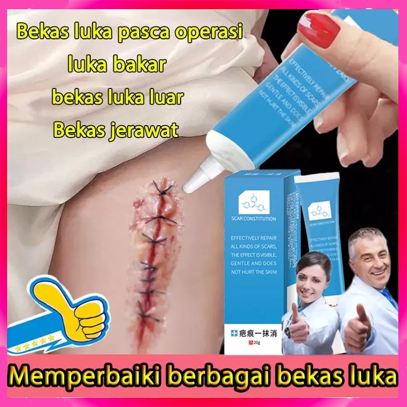 [100% AMPUH]  Gel penghilang bekas luka Operasi Memperbaiki bekas luka penghapusan bekas luka Meringankan bekas luka operasi Mencegah