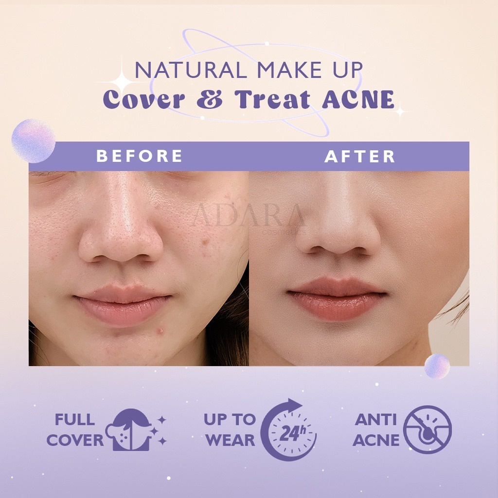 ADARA Spot Eraser 2in1 Concealer + Obat Jerawat