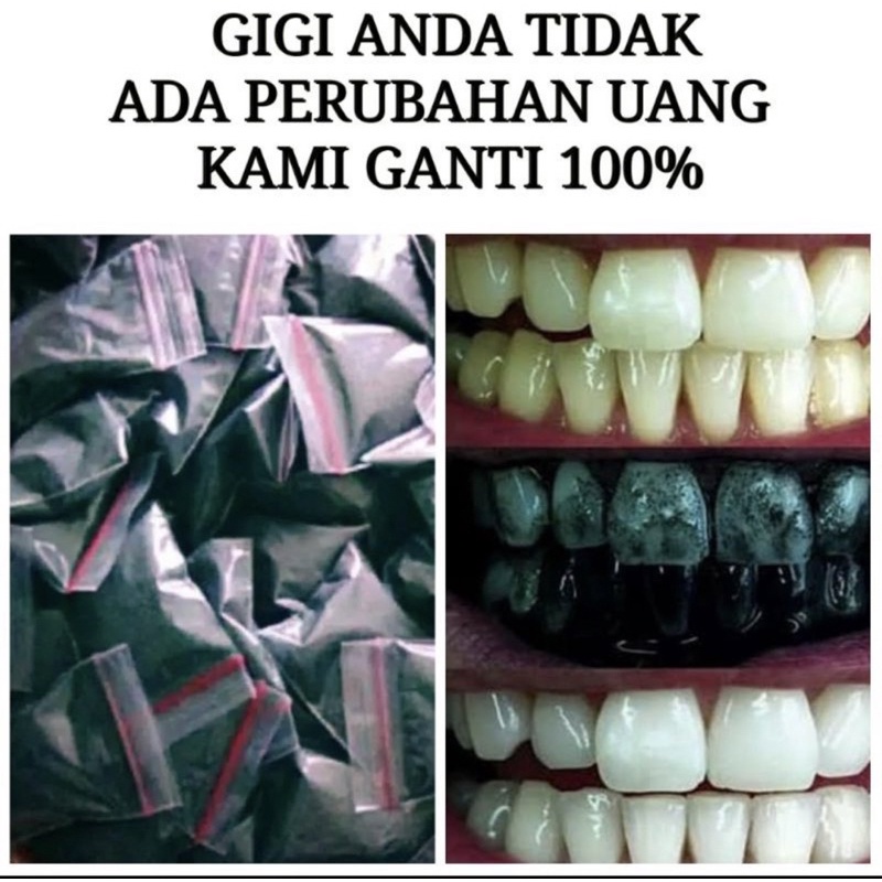 TERMURAH!! COD TEETH WHITENING &quot;Senyum Lebih Cerah dengan Perawatan Pemutihan Gigi Terbaik - Ubah Senyum Anda Hari Ini untuk Tampilan yang Bersinar dan Penuh Percaya Diri!&quot;