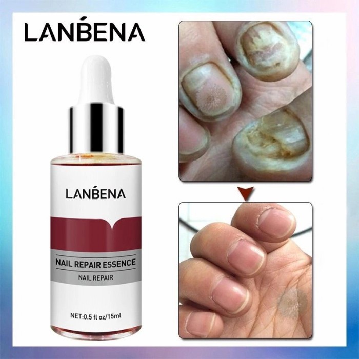 LANBENA NAIL REPAIR SERUM/ SERUM KUKU/ OBAT JAMUR KUKU/