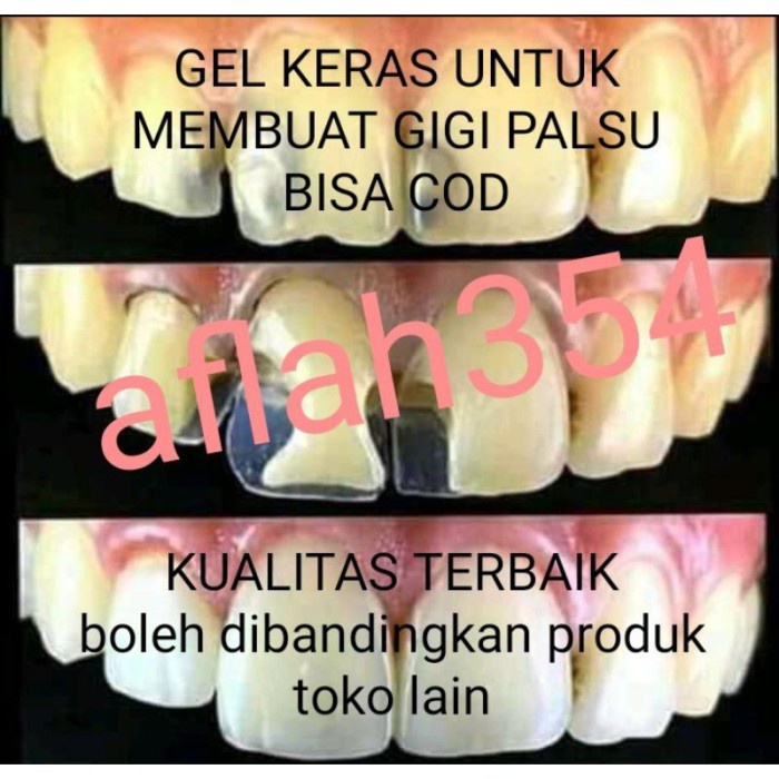 TEMPTOOTH /GEL PENAMBAL GIGI patahPEMBUATGIGI PALSU/ LEM GIGI PALSU DL