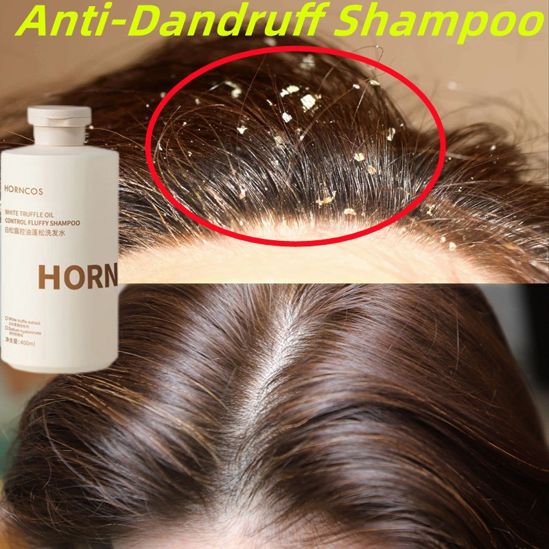 Shampoo Anti Ketombe Shampo Anti Ketombe Dan Gatal Rambut Rontok Anti Kusut Mengontrol Minyak Sampo Anti Ketombe Asam Amino-400ML