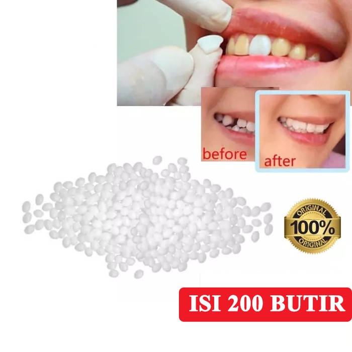 Gigi Palsu Penutup Ompong 200 Pcs Gigi Palsu Penutup Ompong Depan TCI