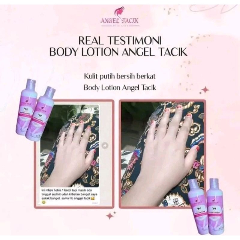 Angel Tacik Lotion Diperkaya Vitamin E Mengatasi Kulit Kering