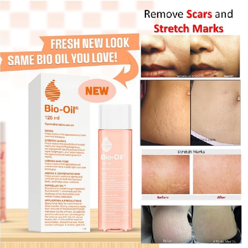 【READY STOCK】Bio Oil 200 ML / Penghilang Bekas Luka / Stretch Mark / Penghilang Bekas Jerawat