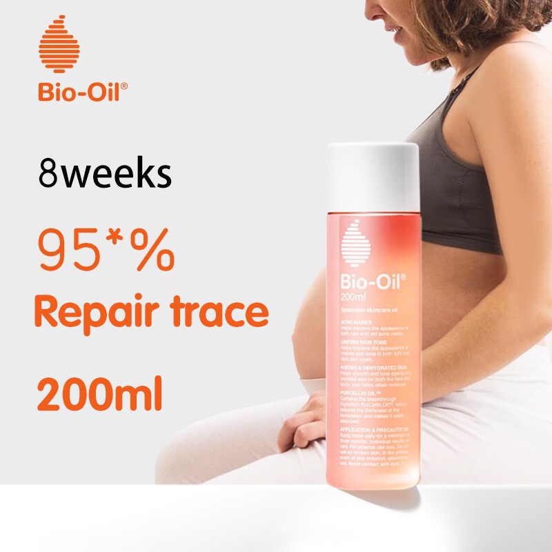 【READY STOCK】Bio Oil 200 ML / Penghilang Bekas Luka / Stretch Mark / Penghilang Bekas Jerawat