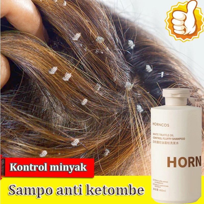 【Beli 2 Gratis 1】 Shampoo Anti Ketombe Shampo Mencegah Berminyak Rambut Rontok Sampo Anti Tungau Gatal Anti Kusut Mengontrol Minyak Asam Amino Panjang-400ml