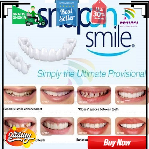 Gigi Palsu SnapO Smile 100% ORIGINAL Authentic Gigi Palsu Atas Bawah - atas bawah