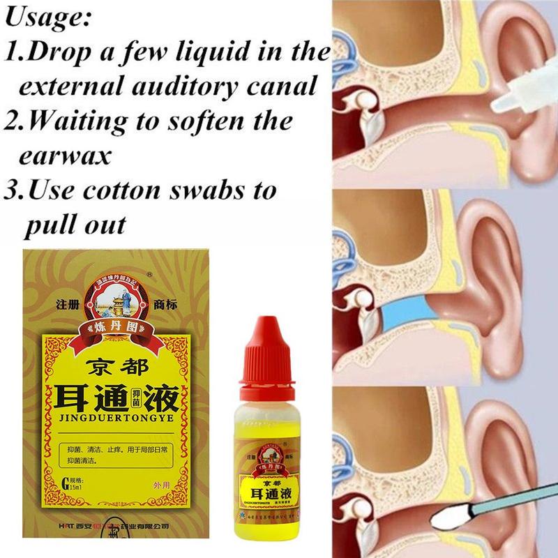 ✅100% Asli Obat Tetes Telinga Cairan Tetes Telinga Herbal JINGDUERTONGYE Pembersih Kotoran Telinga / Tinnitus Tuli Congek / Curek / Bernanah / Berair / Berdengung