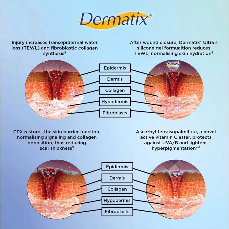[ Dermatix Ultra ] Cream Penghilang Bekas Luka Operasi Iris Tergores Digigit Serangga Nyamuk / Luka Lama / Bakar / Gatal Hitam Koreng Di Kaki Oprasi Ampuh Advanced Scar Formula Gel Krim Wajah Keloid Stretchmark stretch mark Dermatik