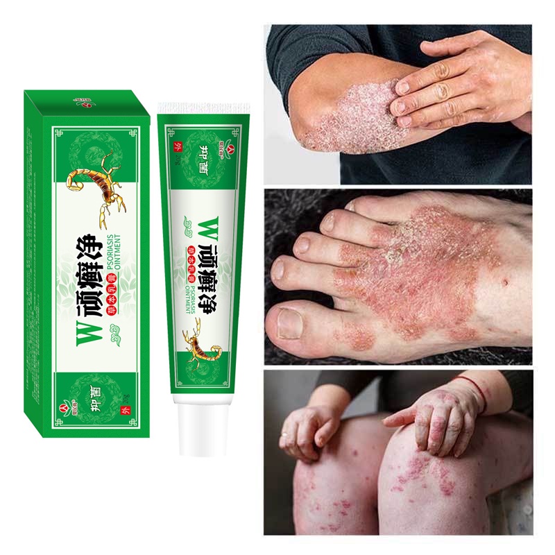 COD Natural Cream | Obat Gatal | Salep Gatal | Cream Gatal | Obat Kulit Gatal | Obat Gatal Menahun |