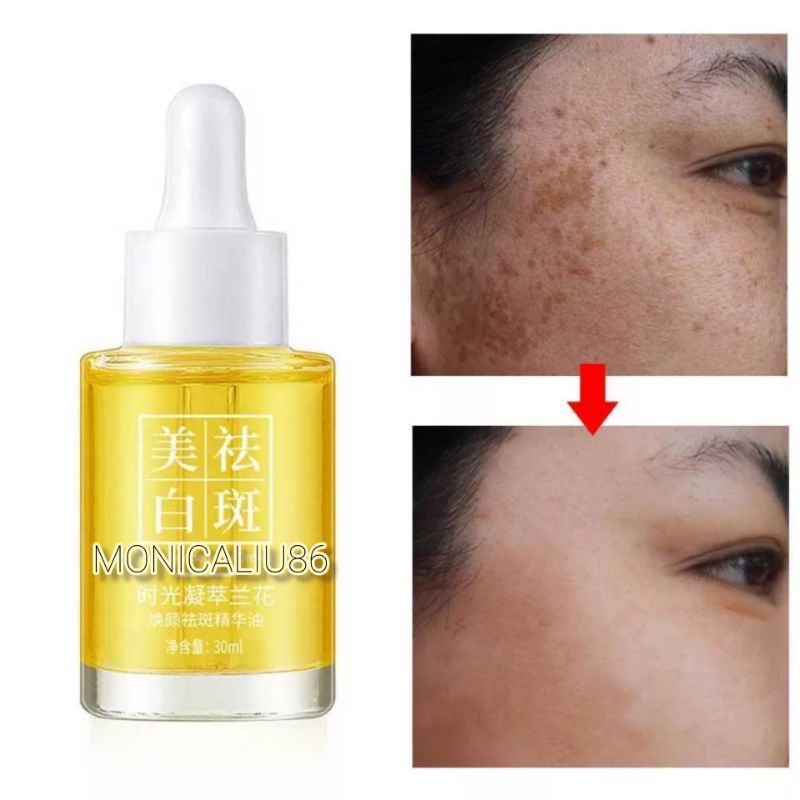 SERUM MINYAK ANGREK ABADI / MINYAK ANGGREK KOREA / SERUM MINYAK ANGGREK ABADI