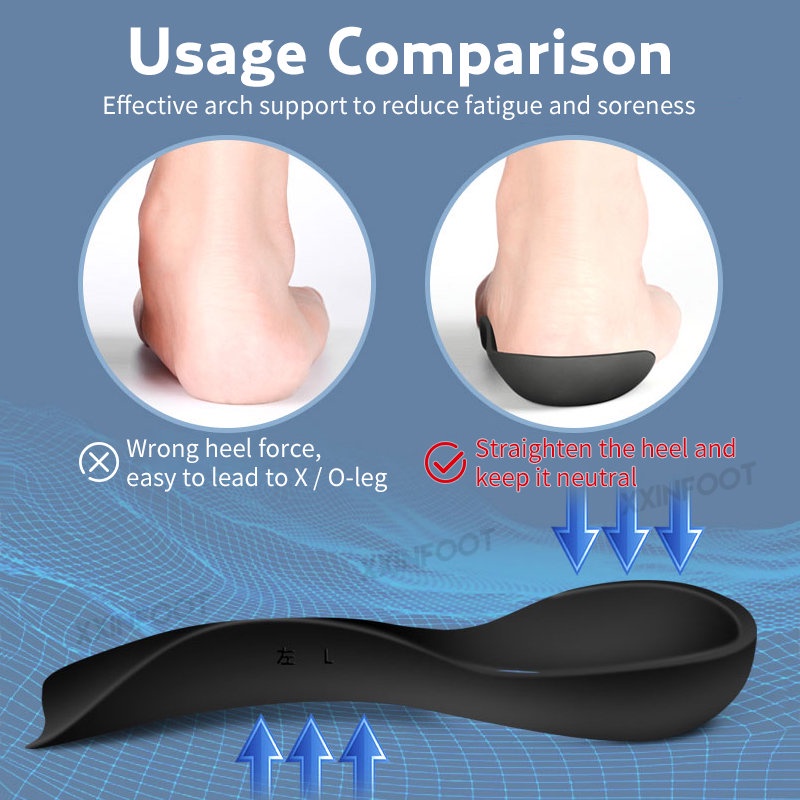 Unisex Flatfoot Orthotics Cubitus Varus Bantalan Kaki Ortopedi Bantalan Kaki Berbentuk O Bantalan Perawatan Sol