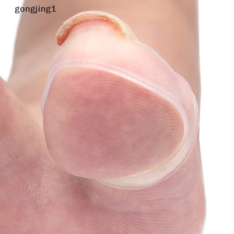 Ggg Alat Koreksi Kuku Kaki Silikon Invisible Ingrown Toe Nail Treatment ID