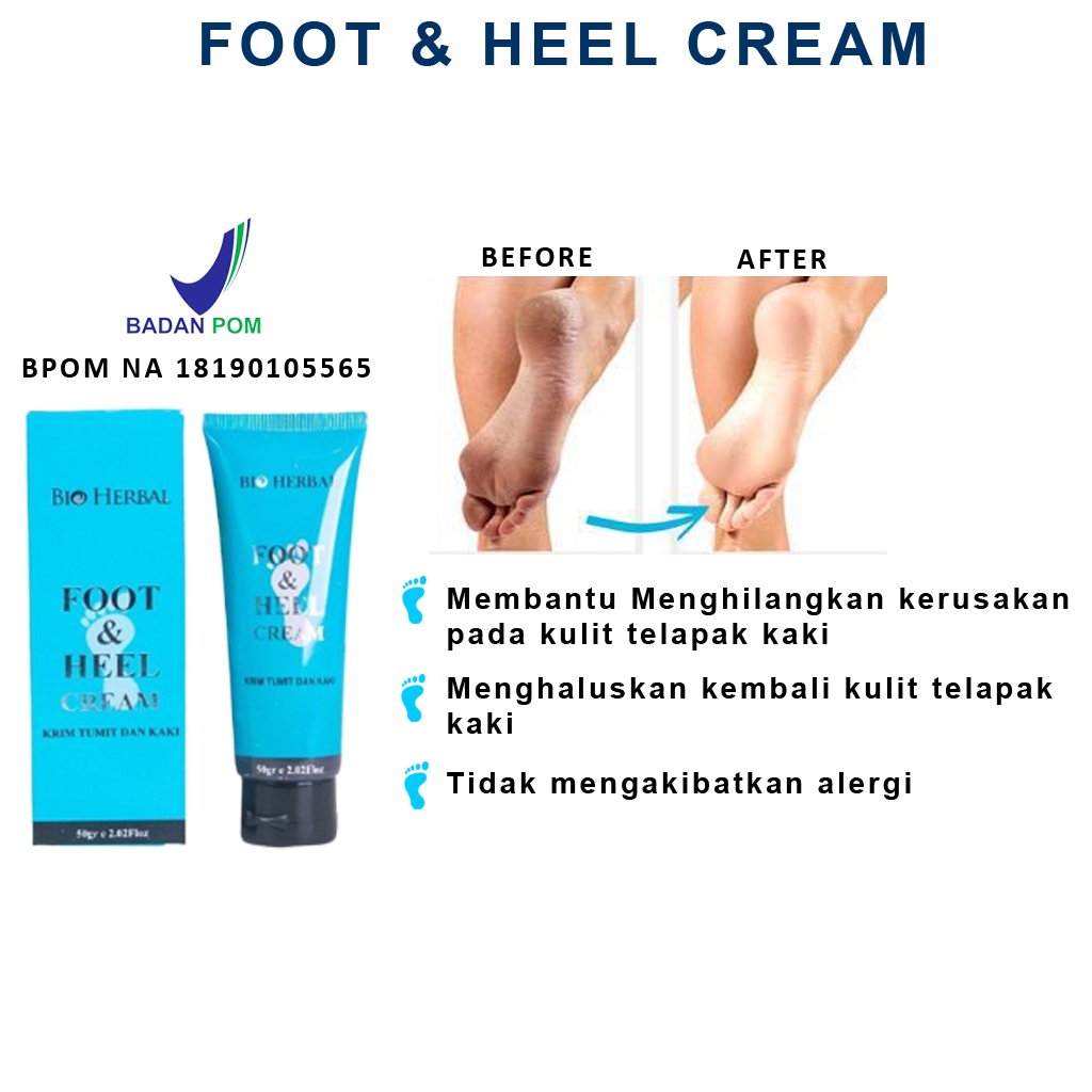 TERAMPUH!! Foot Cream Obat Kaki Pecah Dan Kering Obat Kaki Pecah2 Penghalus Tumit Kaki Ampuh