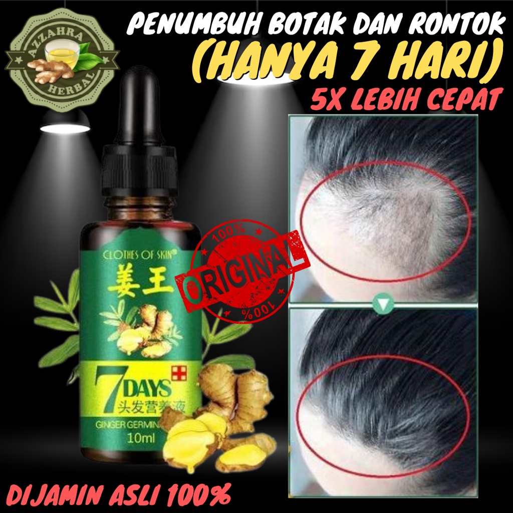 Penumbuh Botak Dan Rontok (HANYA 7 HARI) Pria Anak Bayi Balita Cepat Serum Essence Penghitam Uban Penyubur / 7 Days Ginger Germinal Original