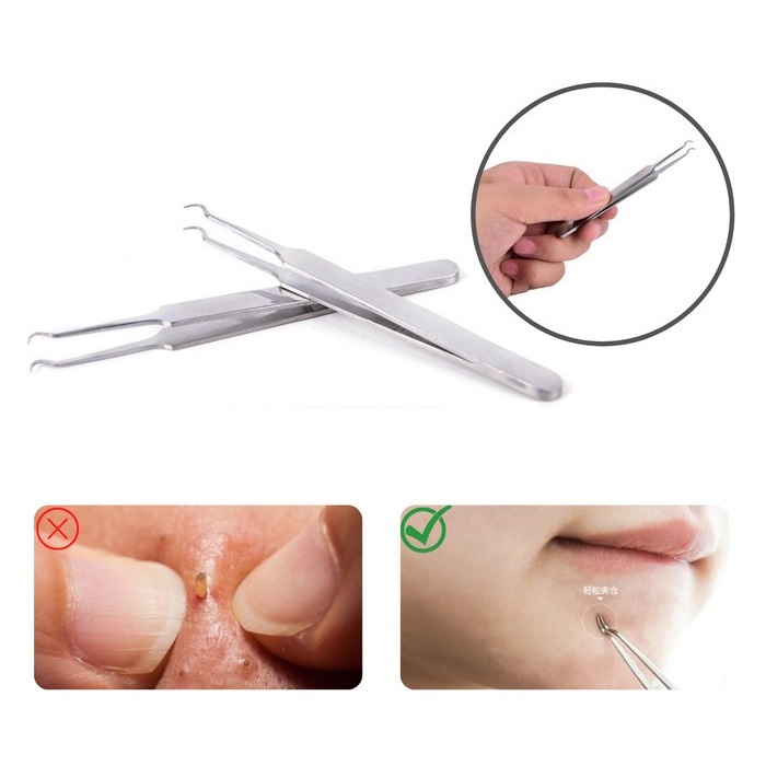 Pinset Jepit Komedo Stainless Steel Blackhead Tweezer Alat Capit Untuk Menghilangkan Komedo Penjepit Komedo