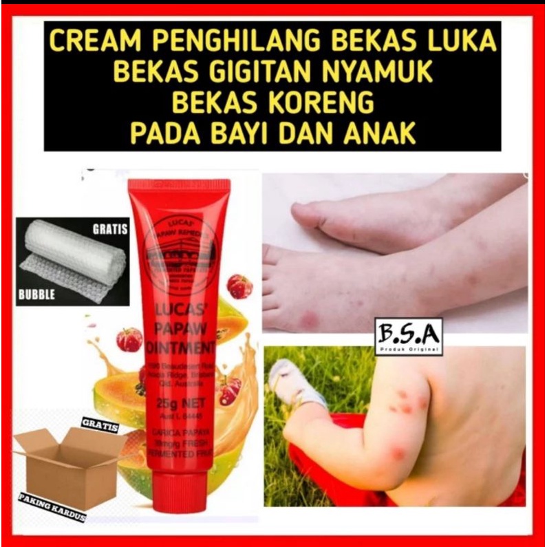 CREAM PENGHILANG BEKAS LUKA BEKAS GIGITAN NYAMUK PADA BAYI DAN ANAK COD NEW