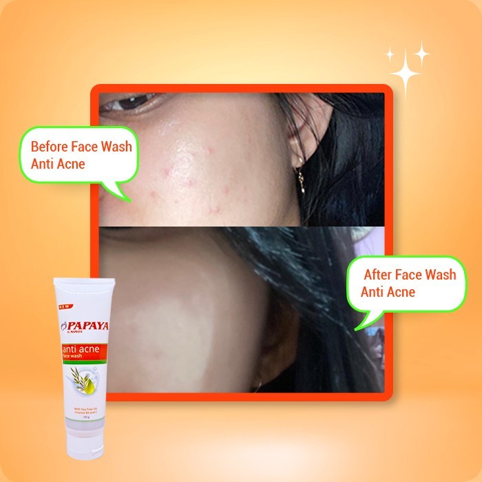 PAPAYA BY MAMAYA ANTI ACNE FACE WASH 100GR