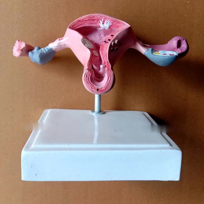 MANIKIN MODEL UTERUS|PathologicaUterus Ovary Model Anatomy - Model 1