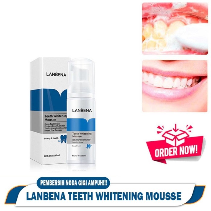 Teeth Whitening Essence Lanbena Pemutih Gigi Kuning Penghilang Kerak