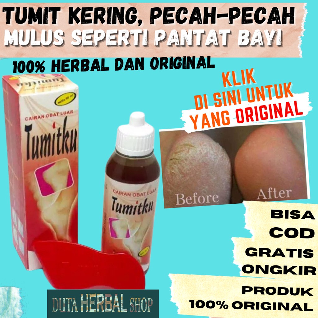 Penghalus Kaki Pecah dan Kering Obat Kaki Tumit Pecah Pecah Kering Kapalan Kasar Penghilang Kaki Kap