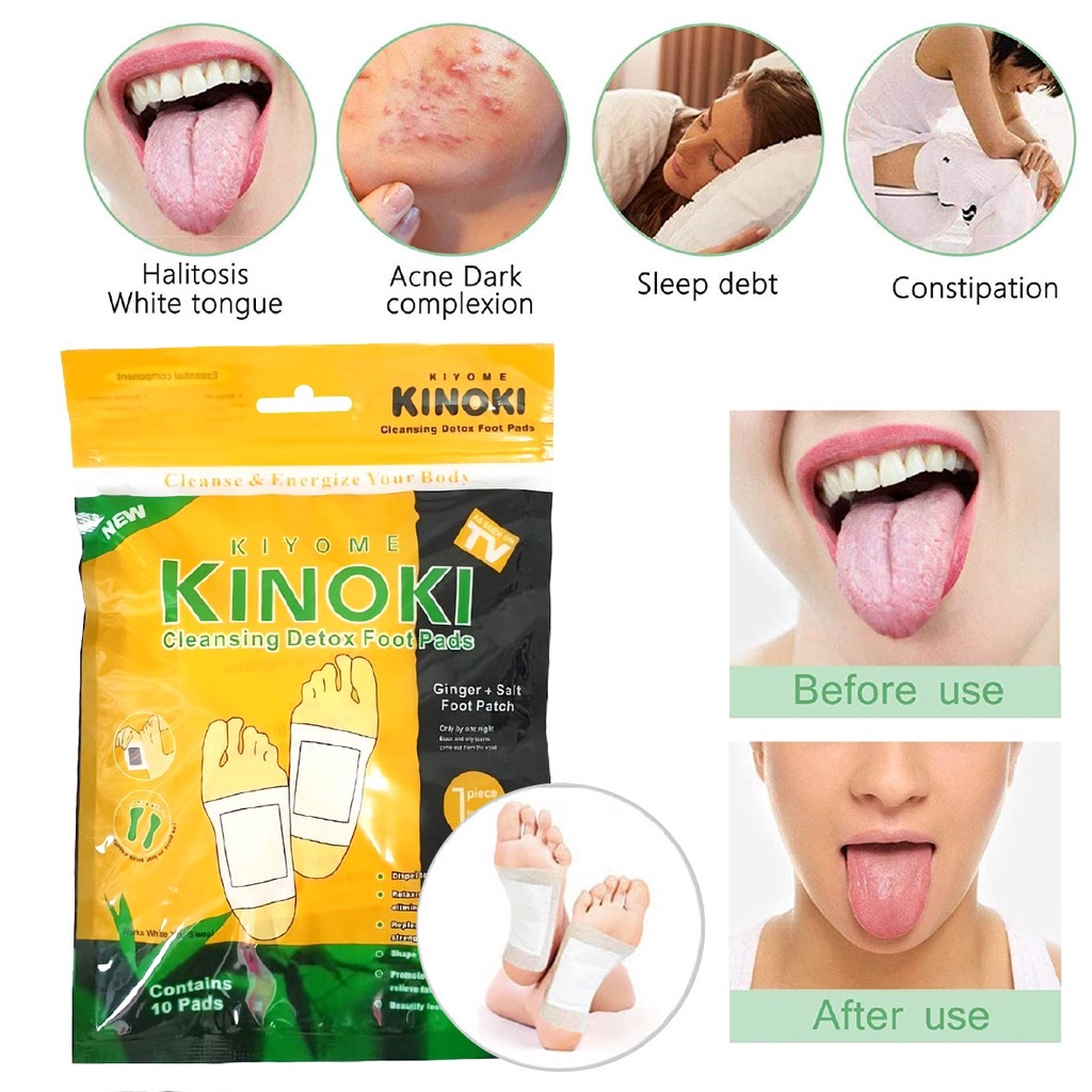 COD SM88  Koyo kaki Kinoki GOLD Kinoki Koyo Kesehatan Detox Toksin Ampuh Buang Racun