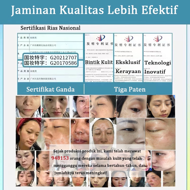 Krim Pemutih Bintik Efektif 7X Niacinamide Menghilangkan Melasma 100% ORI Salep Flek Hitam Melasma Ampuh Salep Flek Bandel Whitening Night Cream Penghilang Flek Membandel Menghilangkan Bintik Melasma Untuk Menghilangkan Chloasma, Flek Hitam, Jerawat