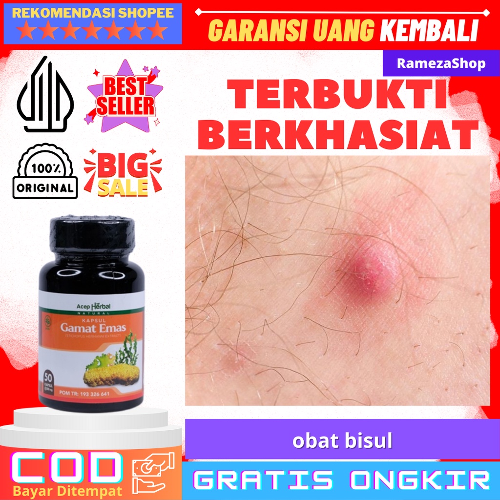 obat bisul Obat Bisul - Obat Bisul Di Pantat - Obat Bisul Pada Kelamin - Obat Bisul Anak - Obat Bisu