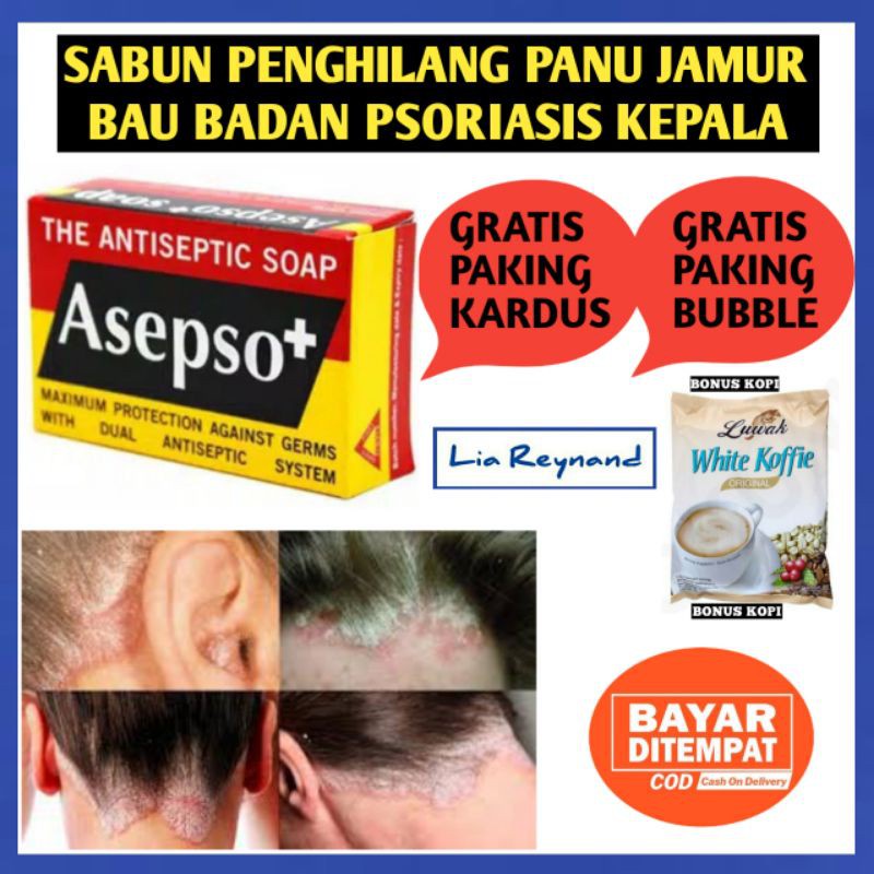 SABUN PENGHILANG PANU JAMUR BAU BADAN PSORIASIS KEPALA XOD