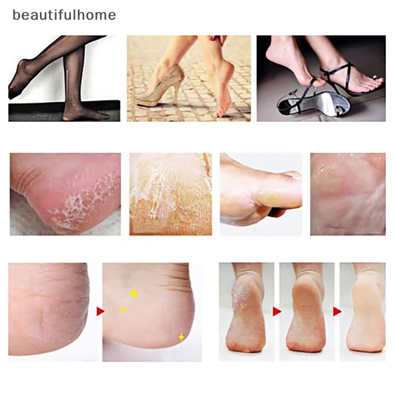 {beautifulhome} Beberapa Warna Perawatan Kaki Tahan Lama Pedicure Mesin Alat Cukur Penghilang Kulit Mati Keras Pemotong Jagung Shaver Pedicure Feet Tool.