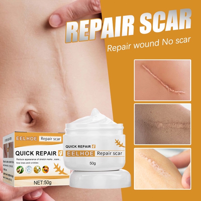 【COD ORI】EELHOE Cream Penghilang Bekas Luka  Hitam/Herbal Scar Removal Cream/Penghilang Bekas Cacar 