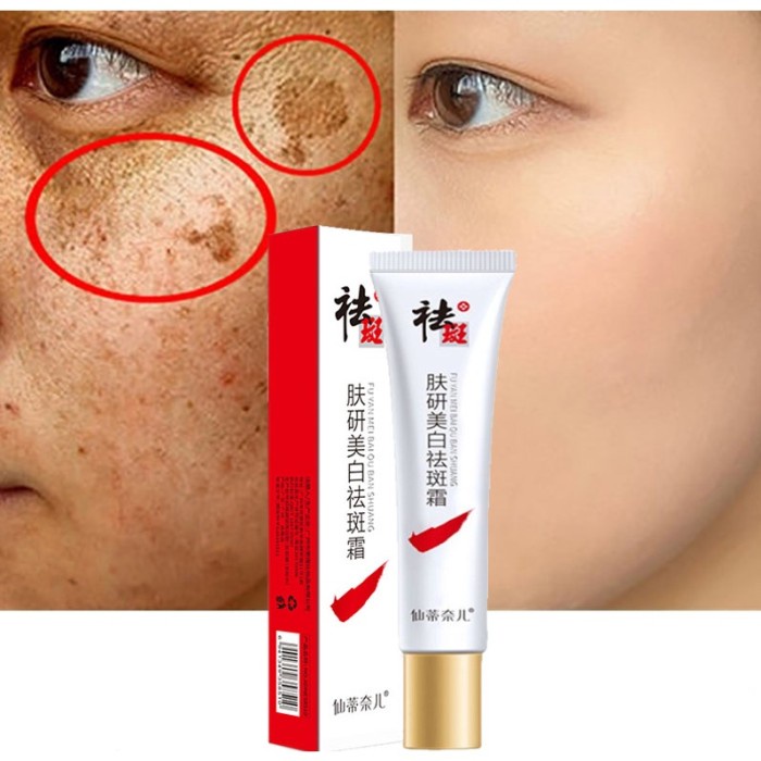 CINDYNAL Whitening Freckle Cream Remove Dark Spots Penghilang