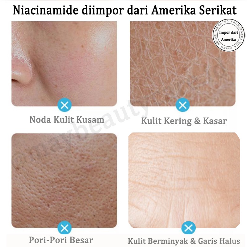 Krim Pemutih Bintik Efektif 7X Niacinamide Menghilangkan Melasma 100% ORI Salep Flek Hitam Melasma Ampuh Salep Flek Bandel Whitening Night Cream Penghilang Flek Membandel Menghilangkan Bintik Melasma Untuk Menghilangkan Chloasma, Flek Hitam, Jerawat