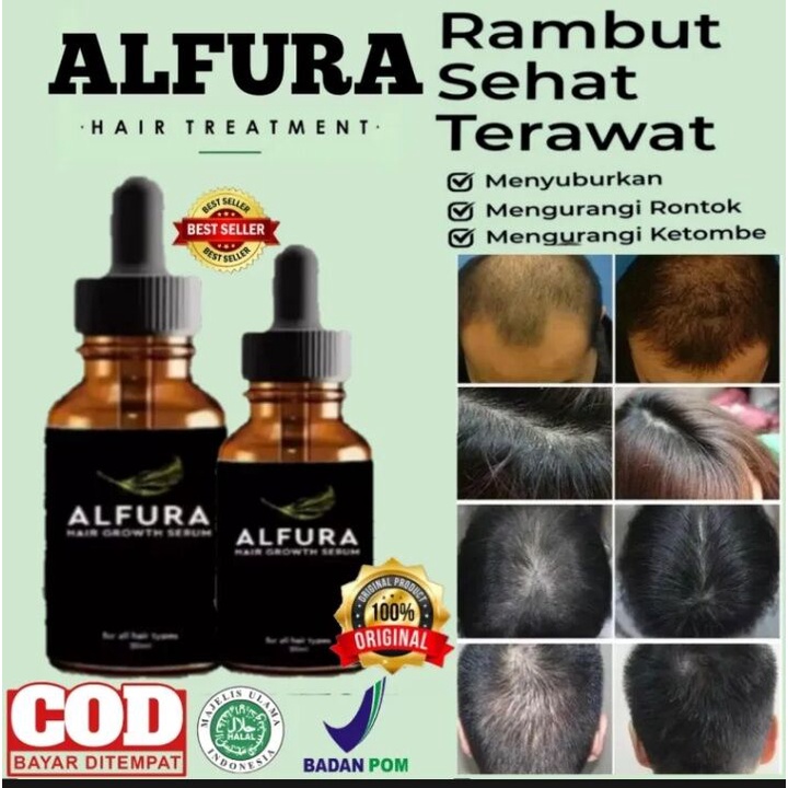 ALFURA SERUM PENUMBUH RAMBUT ORIGINAL-SERUM PENUMBUH AMPUH - penumbuh Rambut Secara Cepat / Obat Pen