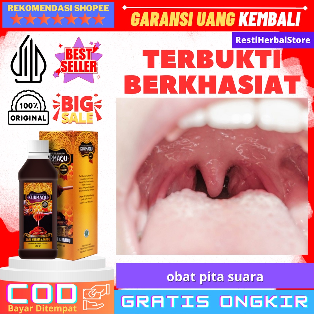 obat pita suara  Obat Pita Suara, Obat Gurah Suara Merdu, Obat Peninggi Suara, Obat Suara Merdu, Oba