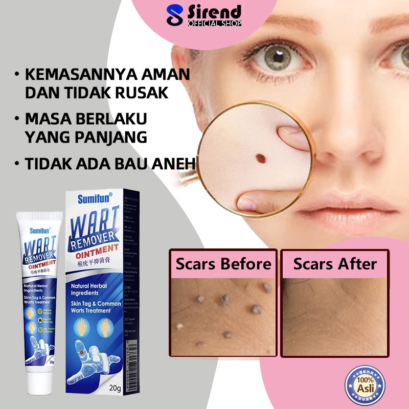 SUMIFUN Wart Remover Ointment alat obat penghilang kutil penghilang tahi lalat obat kutil di leher obat menghilangkan tahi lalat obat tahi lalat penghilang wart remover menghilangkan bekas luka wart remover pembersih kutil