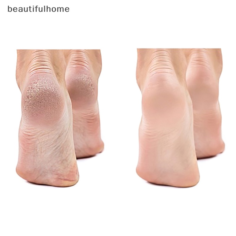 {beautifulhome} Beberapa Warna Perawatan Kaki Tahan Lama Pedicure Mesin Alat Cukur Penghilang Kulit Mati Keras Pemotong Jagung Shaver Pedicure Feet Tool.