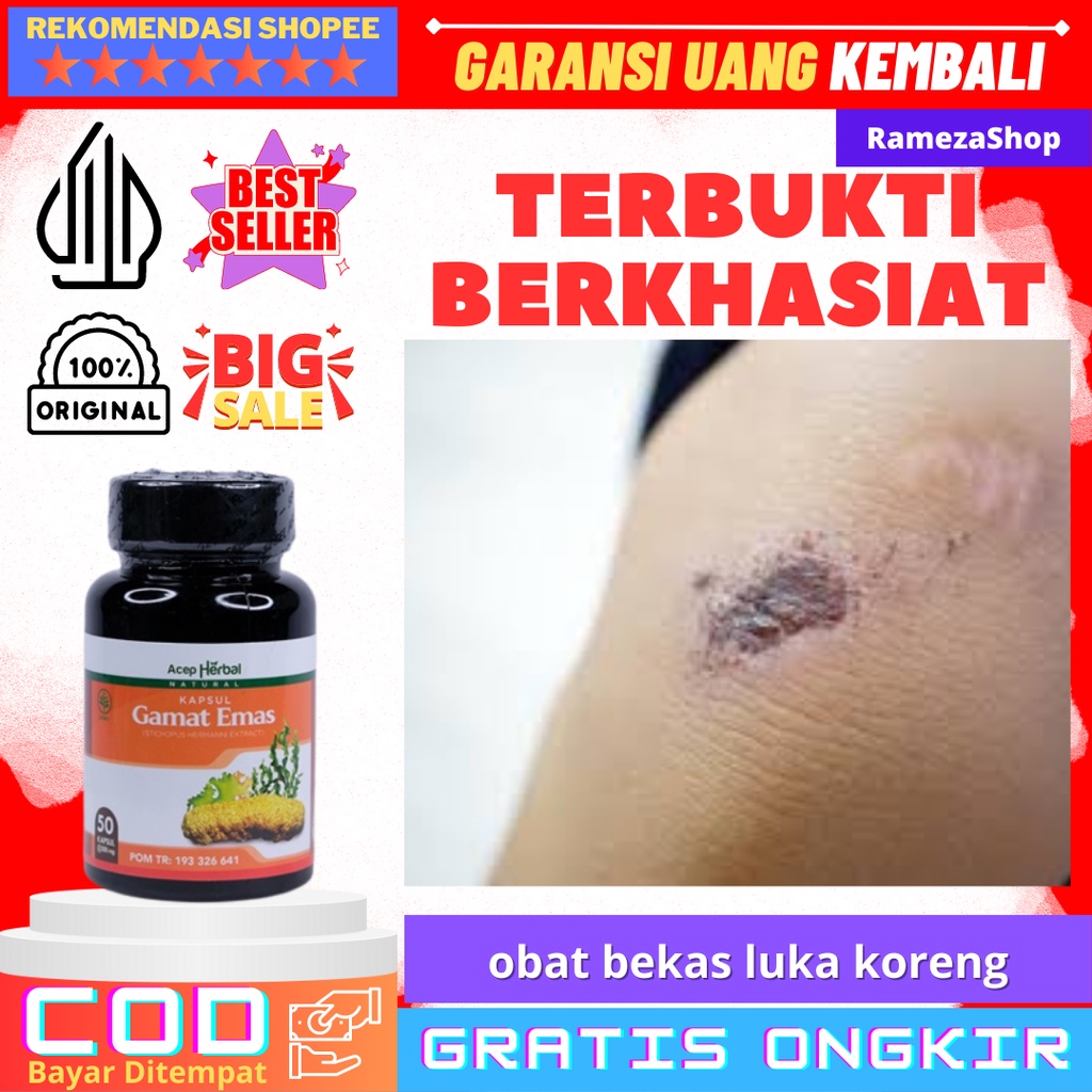 obat bekas luka koreng obat penghilang bekas koreng menghilangkan bekas luka dan koreng penghilang b