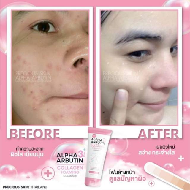 Precious Skin Thailand Alpha Arbutin 3+ Collagen Foaming Face Cleanser 120ml / Face Wash