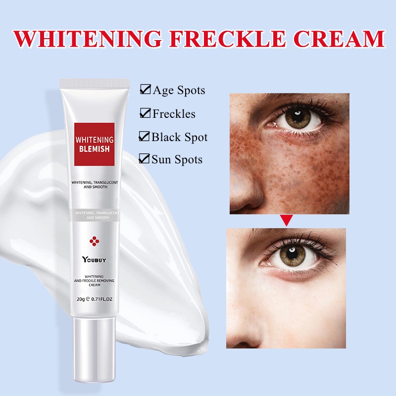 Youbuy Whitening Freckle Cream Krim Pemutih Bintik Wajah Kulit Mencerahkan Remove Dark Spots Anti Freckle Cream Niacinamide Melasma Brighten Cream -20Gr