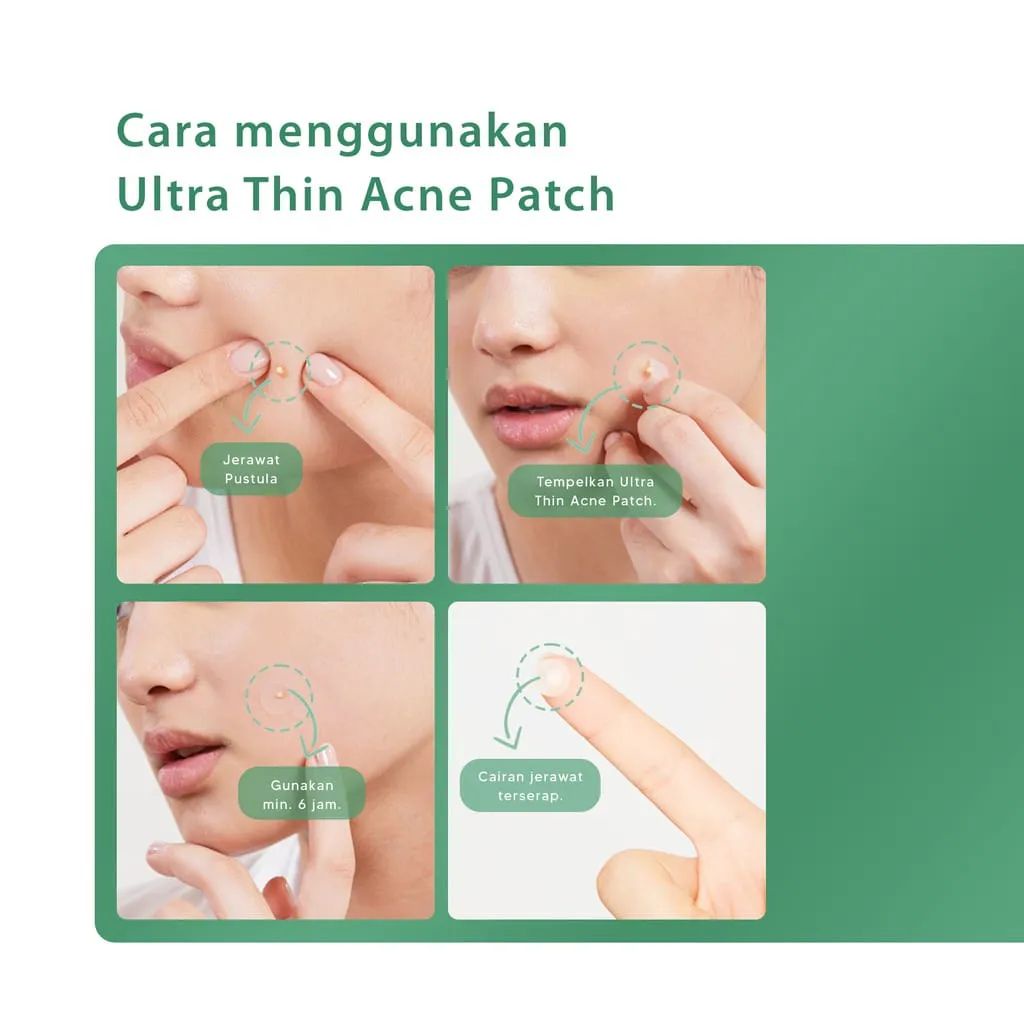 ACNAWAY Ultra Thin Acne Patch 24 pcs-Acne Treatment Stiker Jerawat SATUAN
