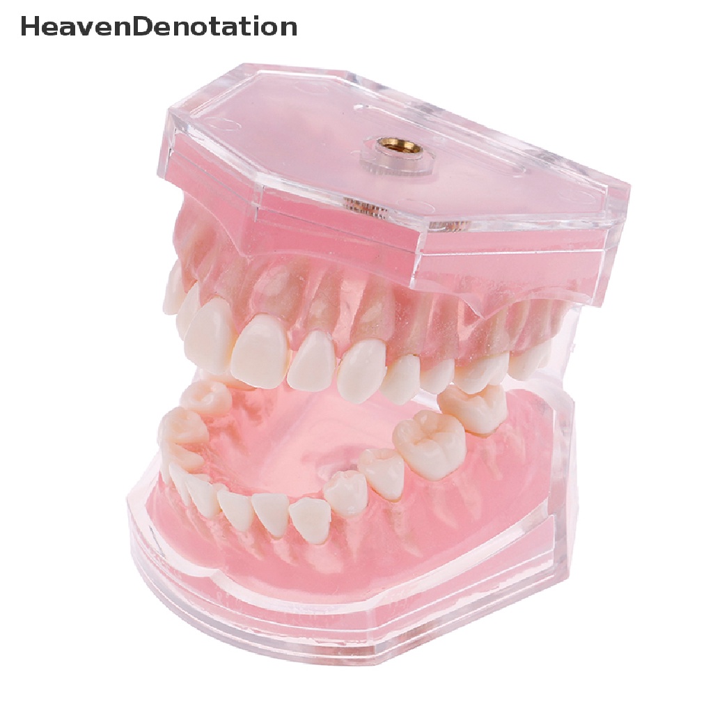 [HeavenDenotation] Plastik typodont orthodontic model Standar4004Dengan 28gigi Lepas HDV