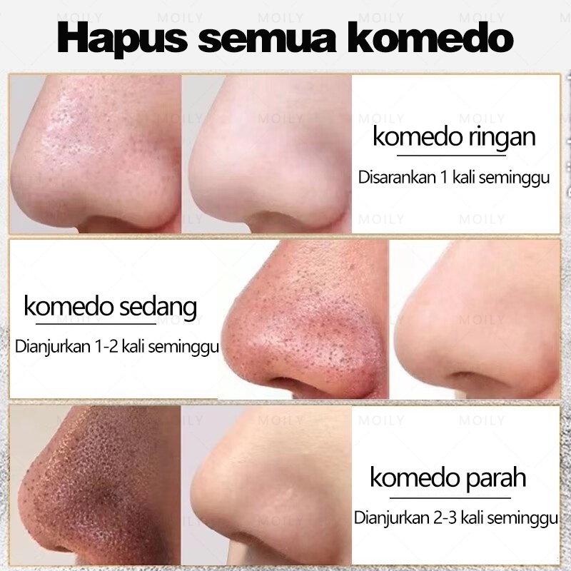 Masker penghilang komedo Pembersih komedo blackhead mask 80g Penghilang  bekas jerawat Komedo memeandel kulit kasar flek hitam pori2